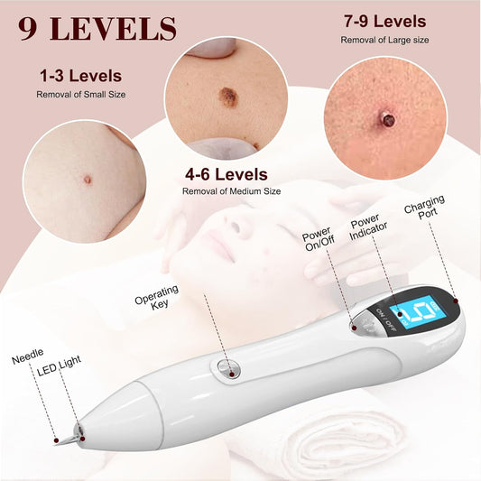 LM 1000 SkinTag Remover Home Use, Removal of Common Warts, SkinTags | Easy to Use