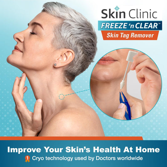 Skin Clinic Freeze 'n Clear Skin Tag Remover - Cryogenic Kit with 8 Precision-Tip Applicators + Tweezers - FDA-Cleared Freezing Skin Tag Treatment Solution for Adults